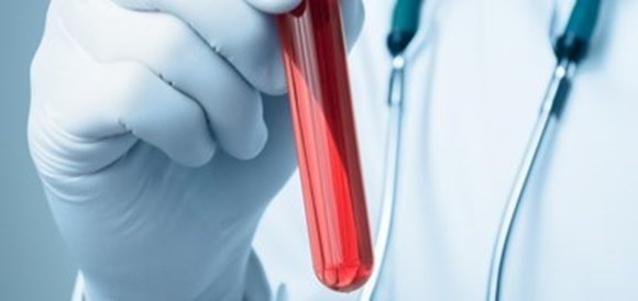 צילום: שאטרסטוק בדיקת Hepatitis A IgG & IgM Antibodies - תמונה